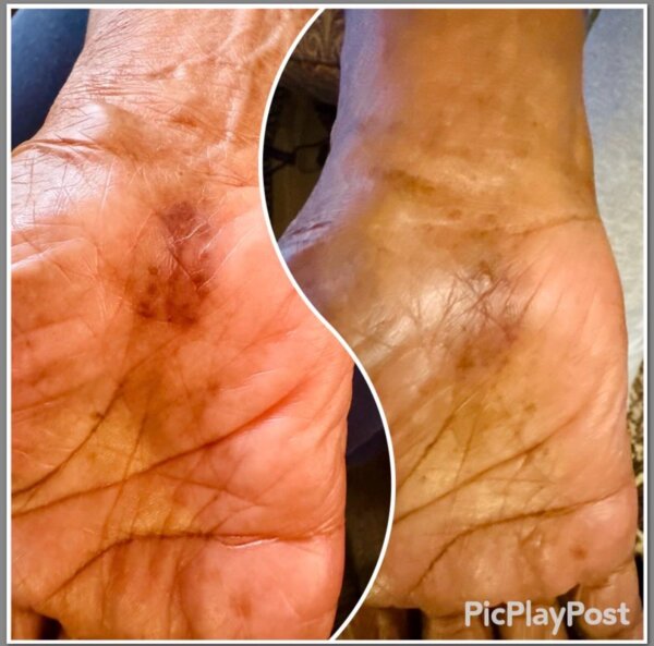 Mama's Legendary Healing Salve - Image 4