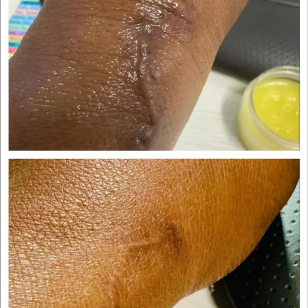 Mama's Legendary Healing Salve